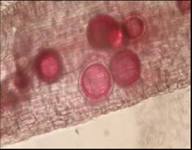 菌根菌之菌絲、孢子柄及孢子分佈 菌根菌之菌絲、孢子柄及孢子分佈